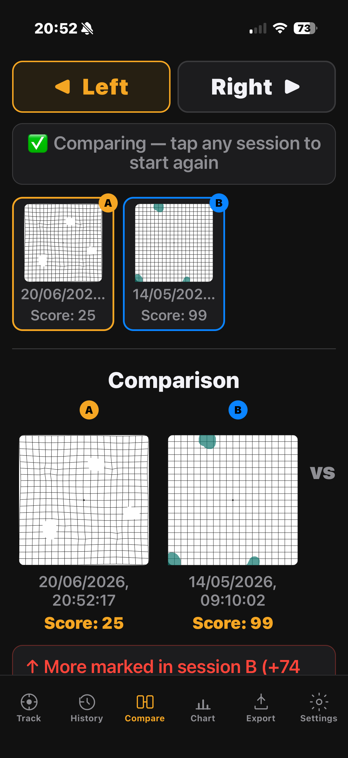 Fovcus compare screen — two Amsler grid sessions side by side