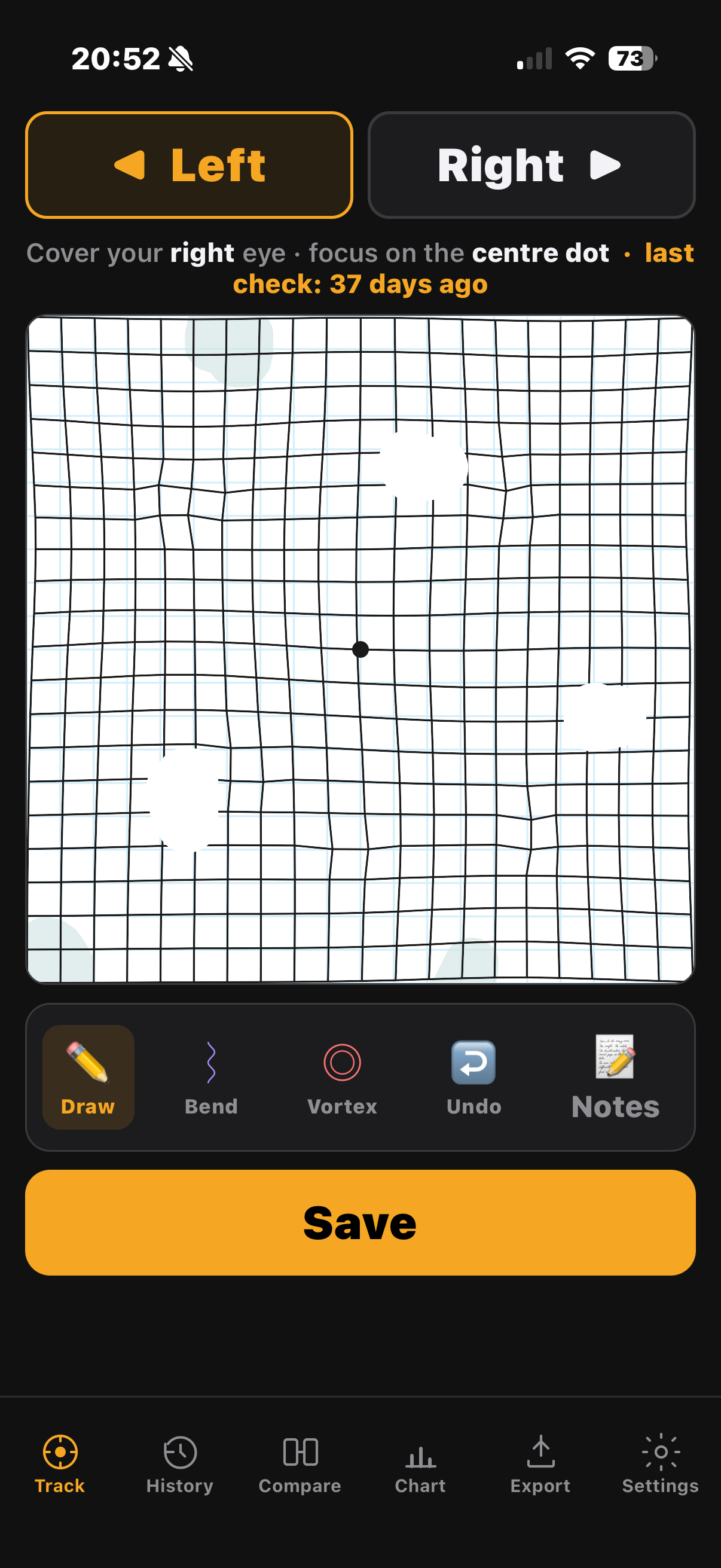 Fovcus Amsler Grid Tracker — the main tracking grid with Draw, Bend and Vortex tools